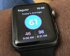Apple Watch: Smartwatch rettet Mann vor tödlicher Lungenembolie