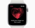 Ein deutsches Ärzteteam lobt die Apple Watch in einem Bericht im European Heart Journal.