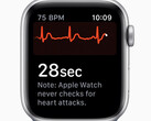Apple Watch: Erkennt die Smartwatch bald Parkinson und erlaubt Diabetes Tracking?