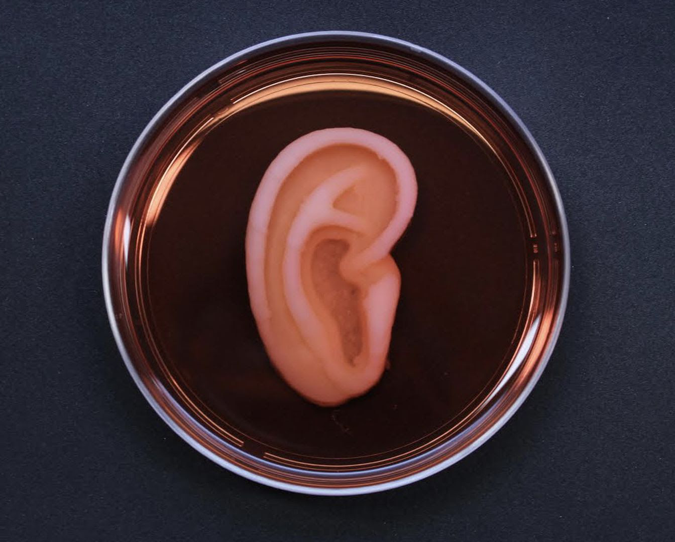 3D bioprinting: the first successfully transplanted living cell ear