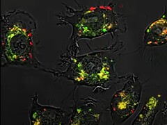 Dank sphärischer Nukleinsäuren war der Wirkstoff 5-Fluorouracil im Tierversuch 20.000-mal effektiver als normal. (Bildquelle: Northwestern University)