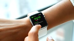 Die Apple Watch 11 und Apple Watch Ultra 3 könnten Blutdruck-Erkennung bieten, ab der Apple Watch 12 ist mit einem größeren Redesign zu rechnen. (Bildquelle: Qardio)