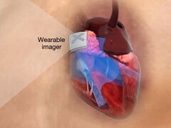 Ultraschallaufnahmen könnten künftig mit einem kleinen Aufkleber durchgeführt werden, statt mit klobigen Geräten im Krankenhaus. (Bild: Nature.com)