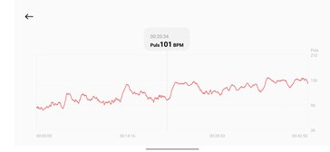 Pulsmessung mit dem Xiaomi Smart Band 10 Pro
