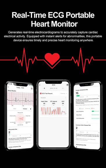 Mindestens die Anfertigung eines EKGs erscheint realistisch (Bildquelle: Rogbid)