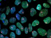 Bild mit Stammzellen, die aus der Haut einer Frau gewonnen wurden (Bildquelle: UCLA via CIRM)
