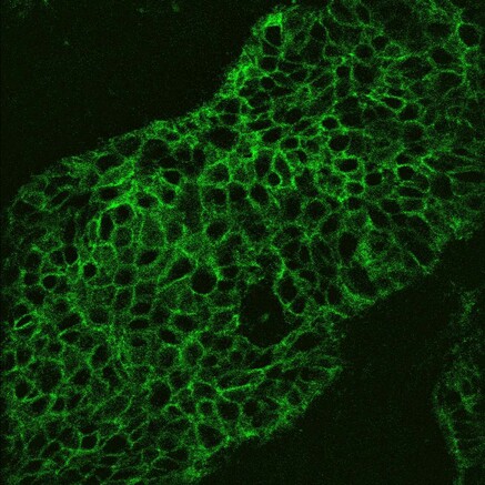 Bild Fraunhofer: Das Fluoreszenz-Bild eines Tumorschnitts, aufgenommen mit dem LSC-Onco-Mikroskop. Die grün fluoreszierende Fläche zeigt Krebszellen an.
