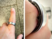 Ein Samsung Galaxy Ring mit aufgeblähtem Akku schickt einen Nutzer ins Krankenhaus. (Bildquelle: Zone of Tech)