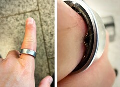 Ein Samsung Galaxy Ring mit aufgeblähtem Akku schickt einen Nutzer ins Krankenhaus. (Bildquelle: Zone of Tech)