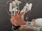 ELAXO: Exoskelett für die Hand
