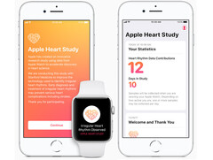 Herz-Studie von Stanford und Apple: Apple Watch findet Herzkranke.