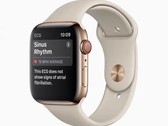 Apple aktiviert die EKG-Funktion, vorerst allerdings nur in den USA