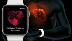 Lebensretter Apple Watch: Apple-Uhr verhindert möglichen Schlaganfall!