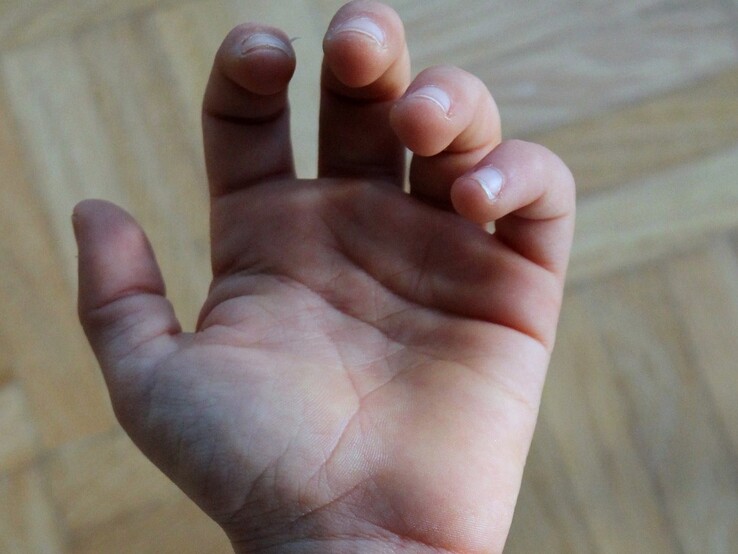 Venen sind nicht sofort sichtbar (Bild von Giulia Marotta auf Pixabay)