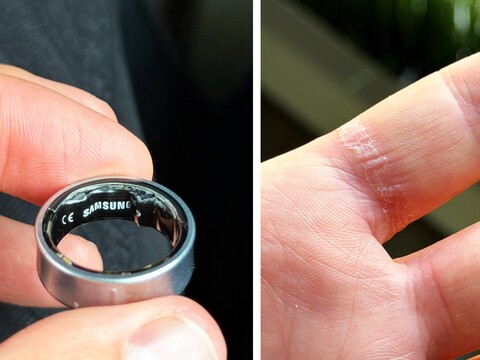 Ein angeschwollener Akku kann bei einem Galaxy Ring schmerzhaft werden. (Bildquelle: Zone of Tech)