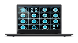 ThinkPad P51s von vorne