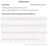 Die EGK-Aufzeichnung der iHEAL 6 ist ordentlich