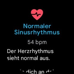 Die Pixel Watch 2 hat eine EKG-Funktion.