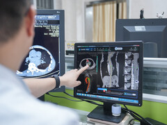 Neues KI-Modell iAorta erkennt lebensbedrohliches Aortensyndrom in Sekunden (Bildquelle: Nature Medicine)