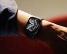 Nicht nur Apples neueste Smartwatch-Modelle können Bluthochdruck erkennen. (Bildquelle: Apple)