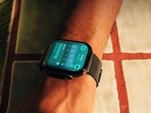 Einige Nutzer haben Probleme mit der Hautverträglichkeit der Apple Watch Series 12.