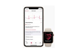 watchOS bringt der Apple Watch 4 auch die EKG-Funktion für europäische Länder.