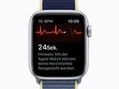 Lebensretter Smartwatch: Apple Watch rettet Briten das Leben!