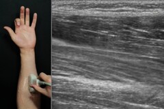 Forschung: Smartwatches bald mit Ultraschall-Handtracking?