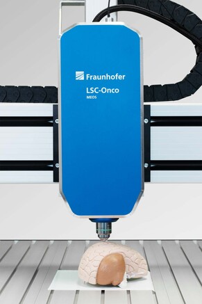 Bild Fraunhofer: Das LSC-Onco-Mikroskop ist durch den Einsatz von MEMS-Technik so klein und kompakt, dass es auch im Operationssaal direkt am Patienten eingesetzt werden kann.