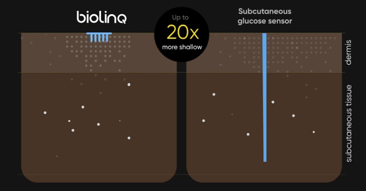 Die Haut soll wesentlich weniger stark penetriert werden (Bildquelle: Biolinq)