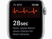 Apple Watch: Erkennt die Smartwatch bald Parkinson und erlaubt Diabetes Tracking?