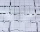 Dank EKG: Apple Watch überwacht in Zukunft Herzgesundheit