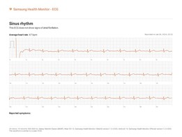 ... und der Galaxy Watch 4 Classic (die beiden Vergleiche wurden durch eine andere Person angefertigt)